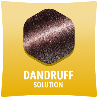 dandruff