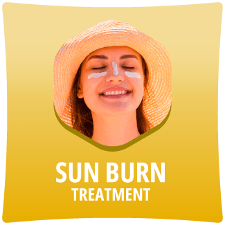 Sun burn