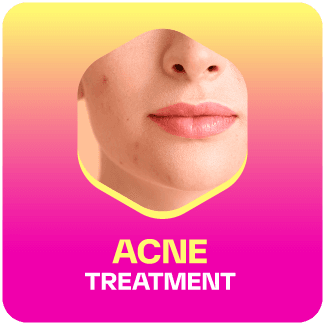 acne