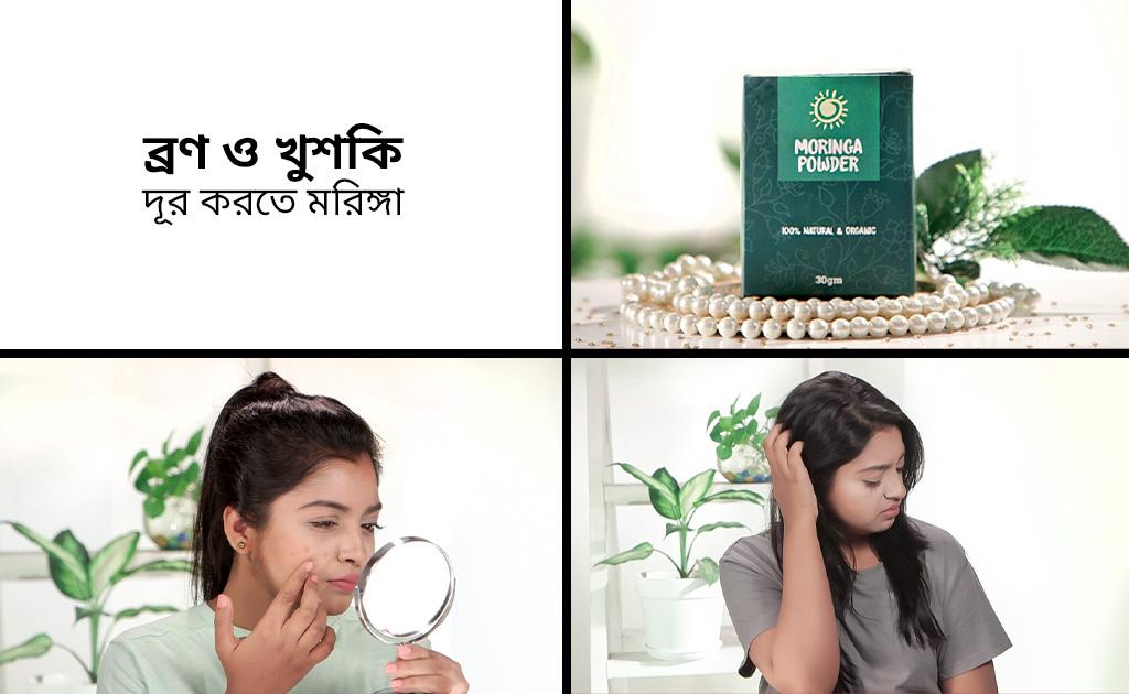 ব্রণ ও খুশকি দূর করতে মরিঙ্গা