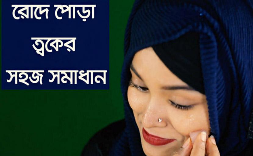 রোদে পোড়া ত্বকের সমাধান হবে খুব সহজে!