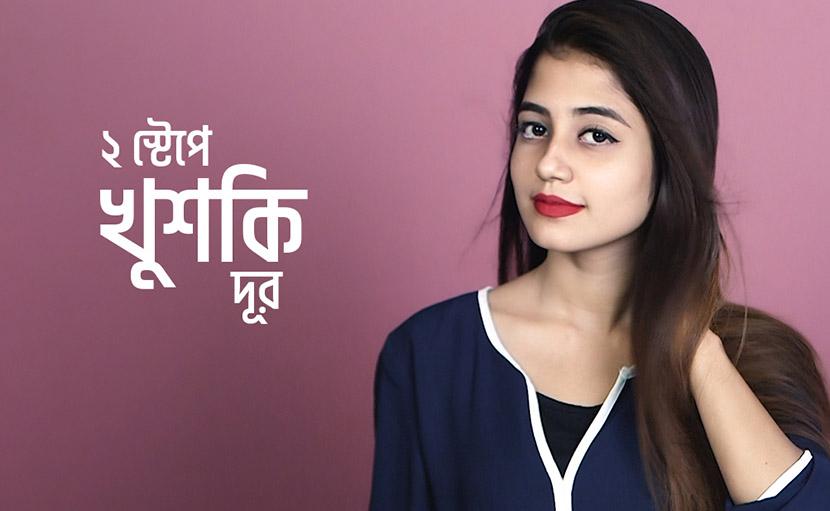 ২ স্টেপে খুশকি দূর করুন সহজেই!