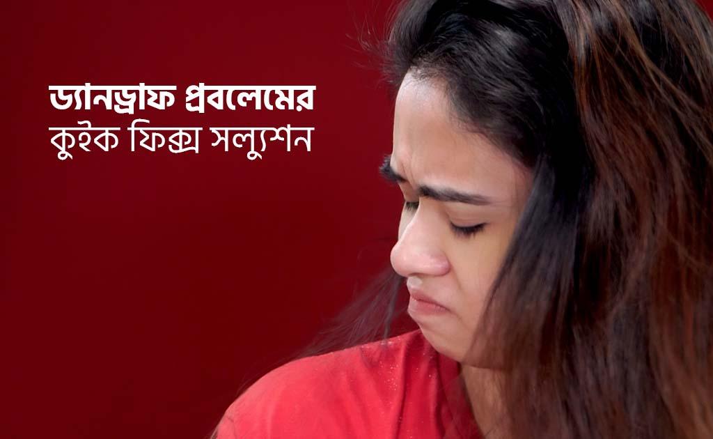 ড্যানড্রাফ প্রবলেমের কুইক ফিক্স সল্যুশন