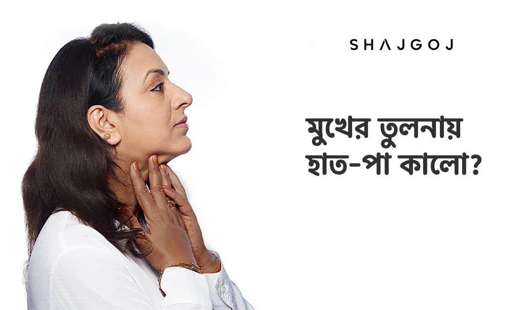 মুখের তুলনায় হাত পা কালো হলে করণীয় কী?