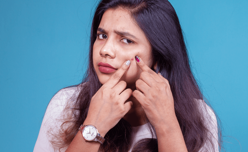 ব্রণের ভোগান্তি থেকে মুক্তি পান নিমিষেই!