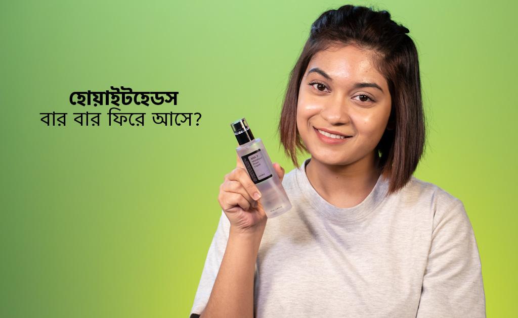 হোয়াইটহেডস বার বার ফিরে আসে?