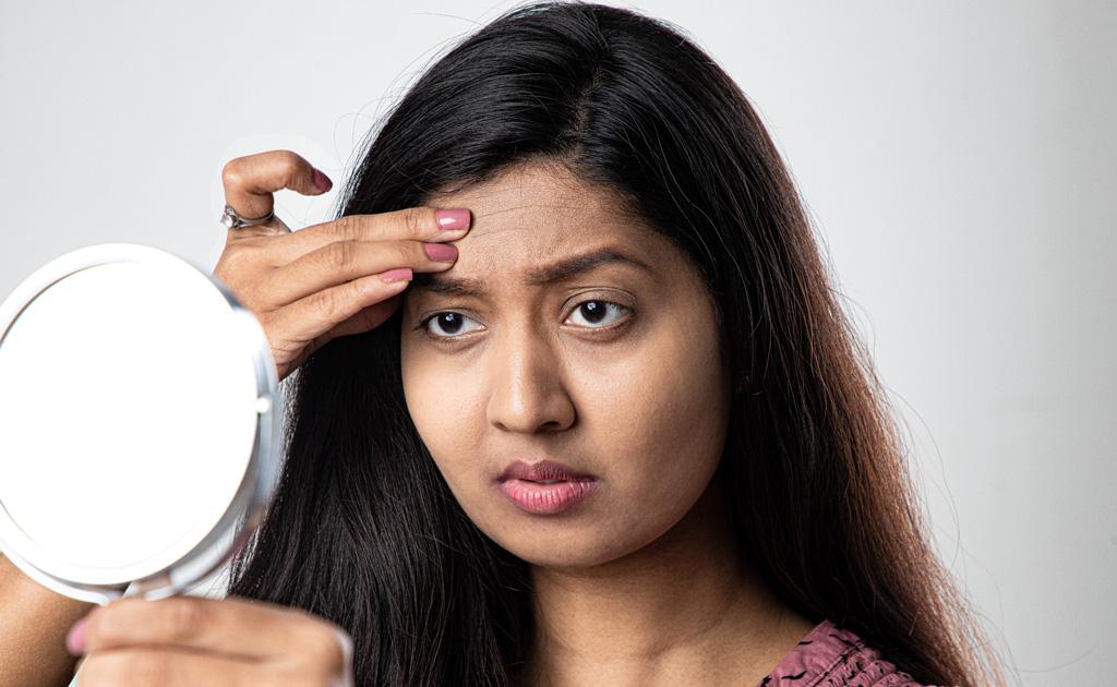 কপালের রিংকেলস ও ফাইন লাইনস কীভাবে প্রিভেন্ট করা যায়?